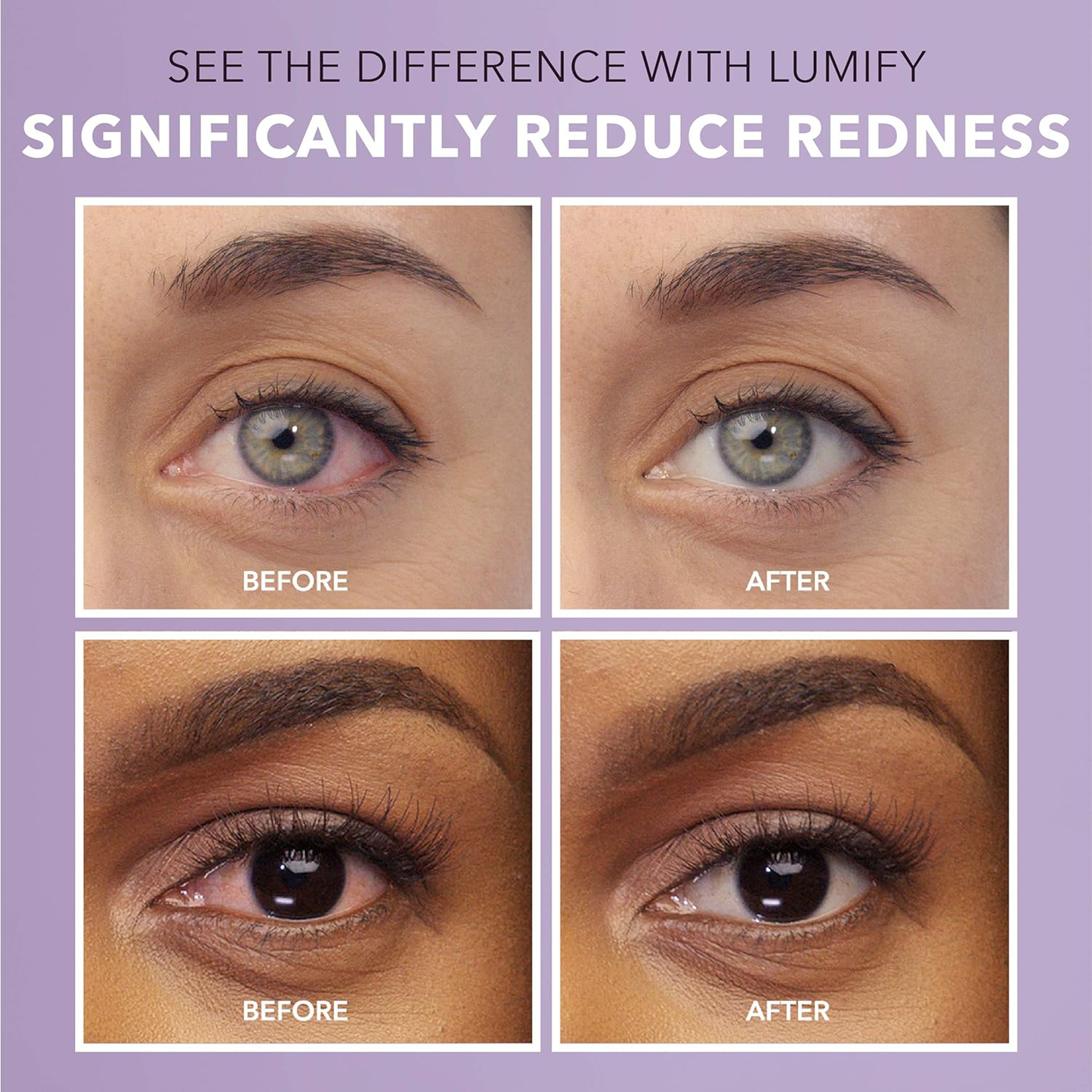 Lumify ®️ Bausch + Lomb XL • Eye Drops Against Hay Fever, Red Eyes & Irritated Eyes • 1x5ml