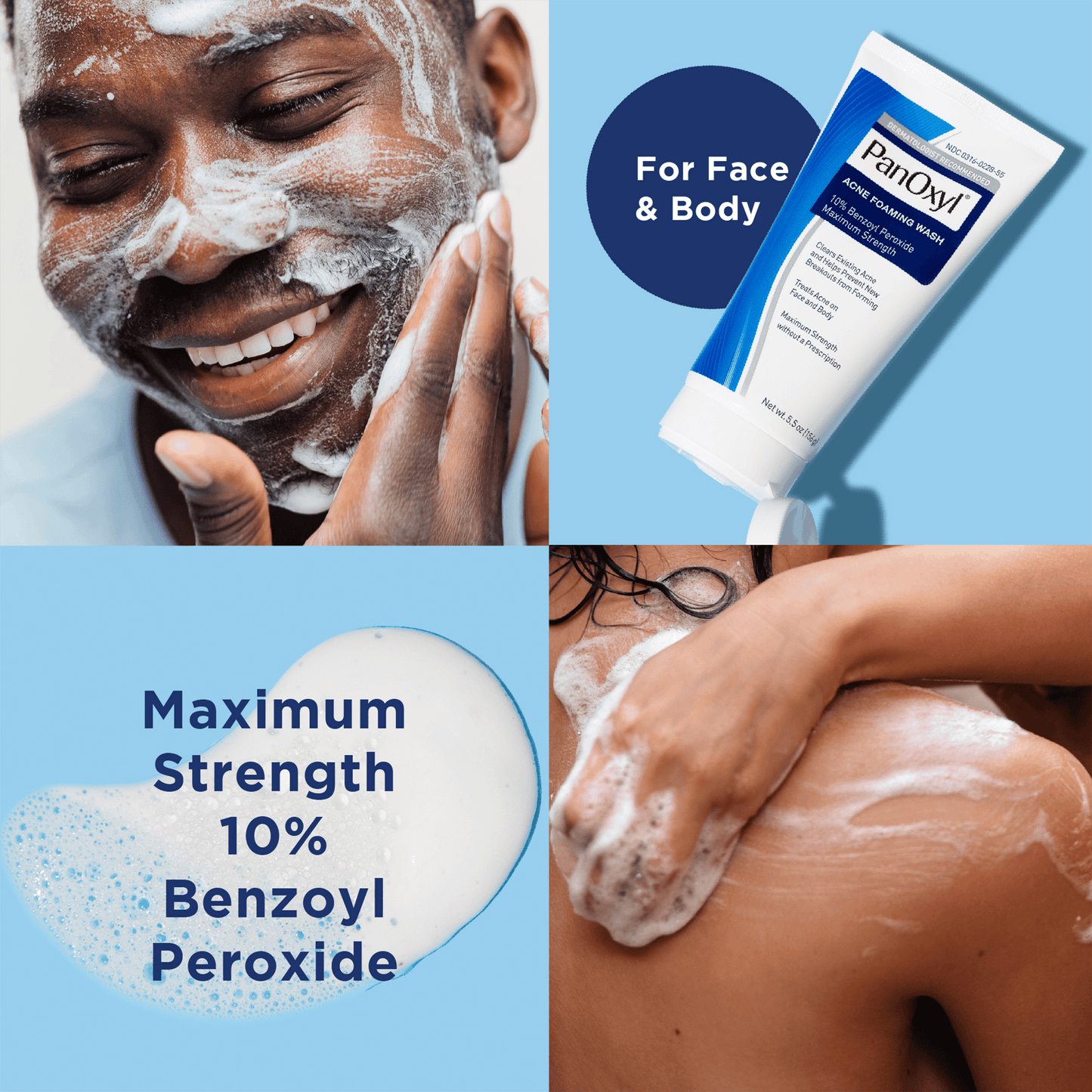 PanOxyl ®️ Acne Foaming Wash 10% Benzoyl Peroxide Maximum Strength • Acne Foaming Wash Against Acne & Further Outbreak Of Acne • 1x156gr